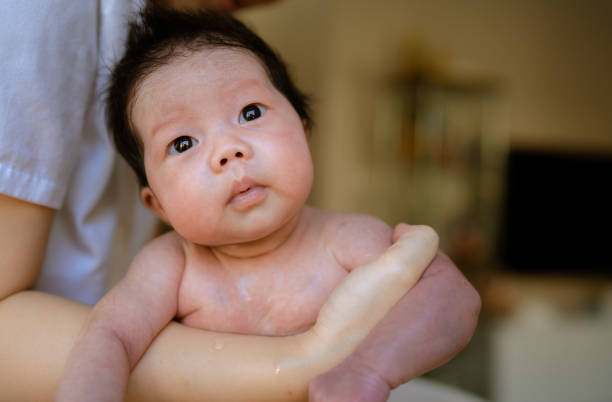 Newborn-Skin-Color