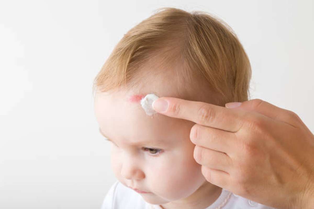 Baby hitting head 2025 on side of crib